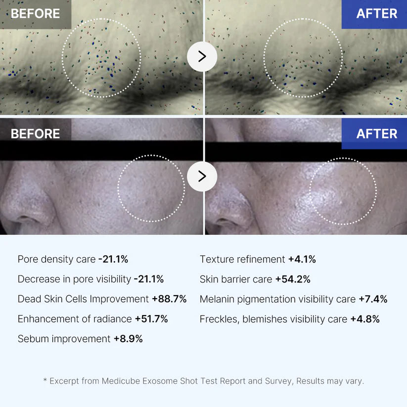 SIFIR EKSOZOM SERUM