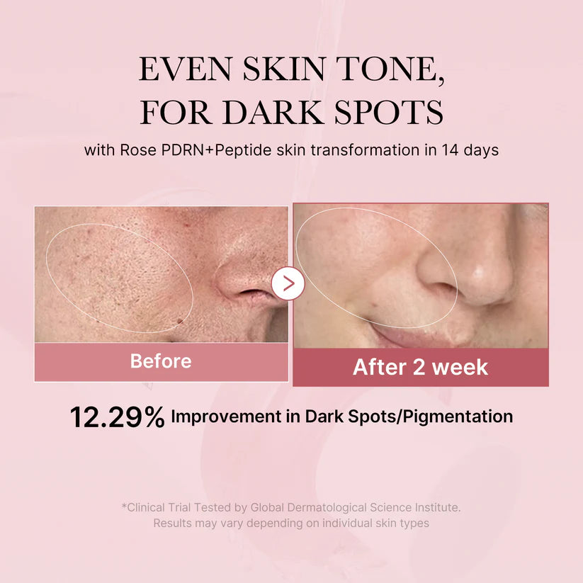 PDRN PEMBE PEPTIT TONİK