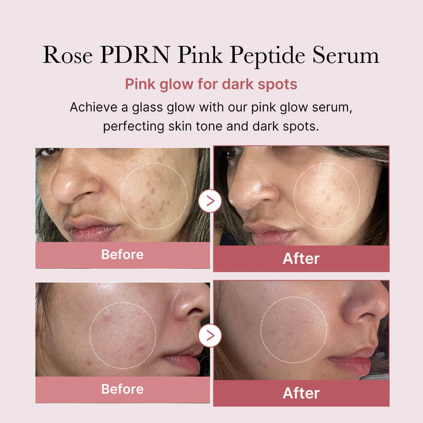 PDRN PEMBE PEPTİT SERUM